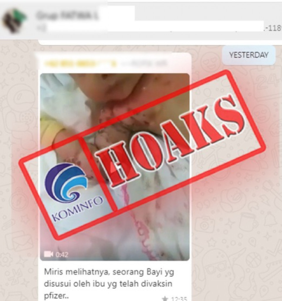 [HOAKS] Bahaya Vaksin Pfizer Bagi Bayi yang Disusui