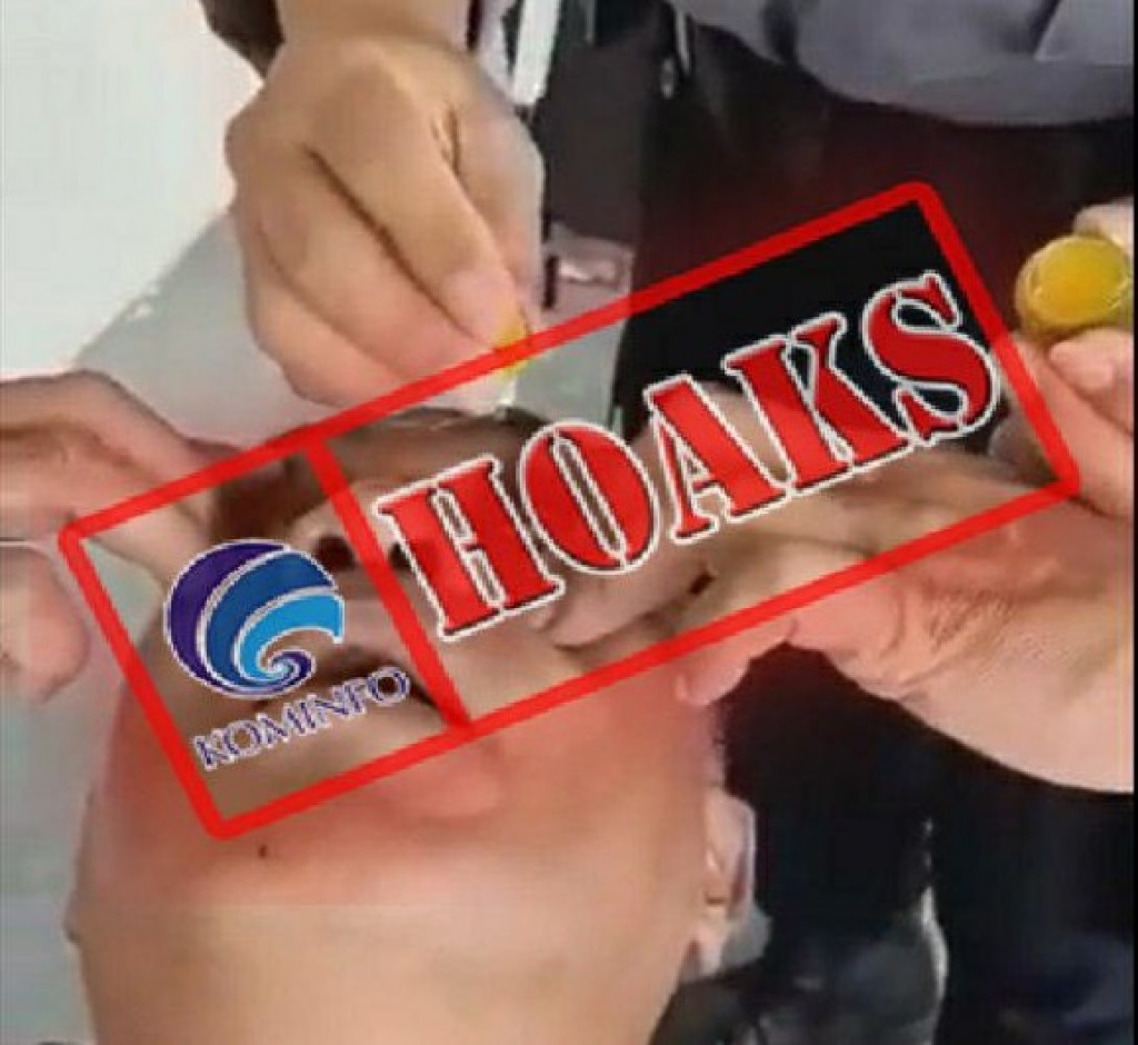 [HOAKS] Tetesan Air Jeruk Nipis Dapat Mengurangi Minus pada Mata