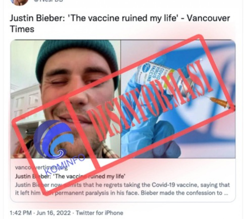 [DISINFORMASI] Justin Bieber Mengaitkan Kelumpuhan Wajahnya dengan Vaksin Covid-19