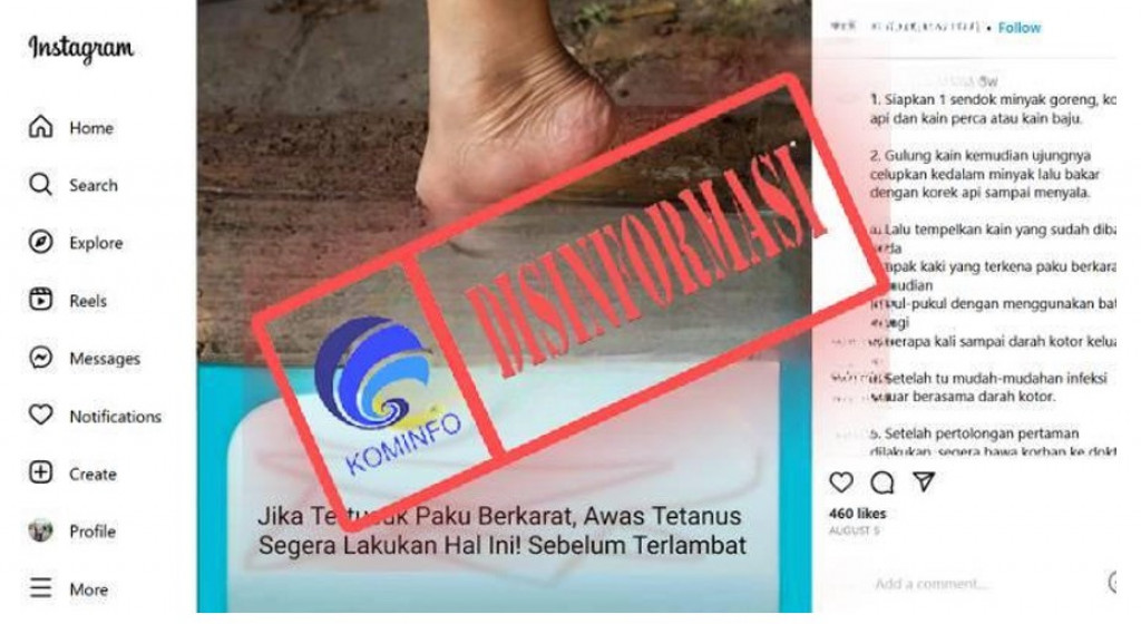 [DISINFORMASI] Penanganan Korban Tertusuk Paku Berkarat