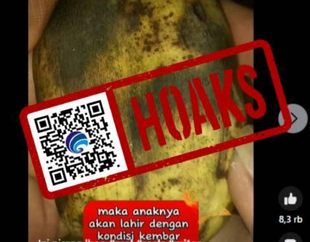 [HOAKS] Pisang Dempet Sebabkan Anak Lahir dengan Kondisi Kembar Siam