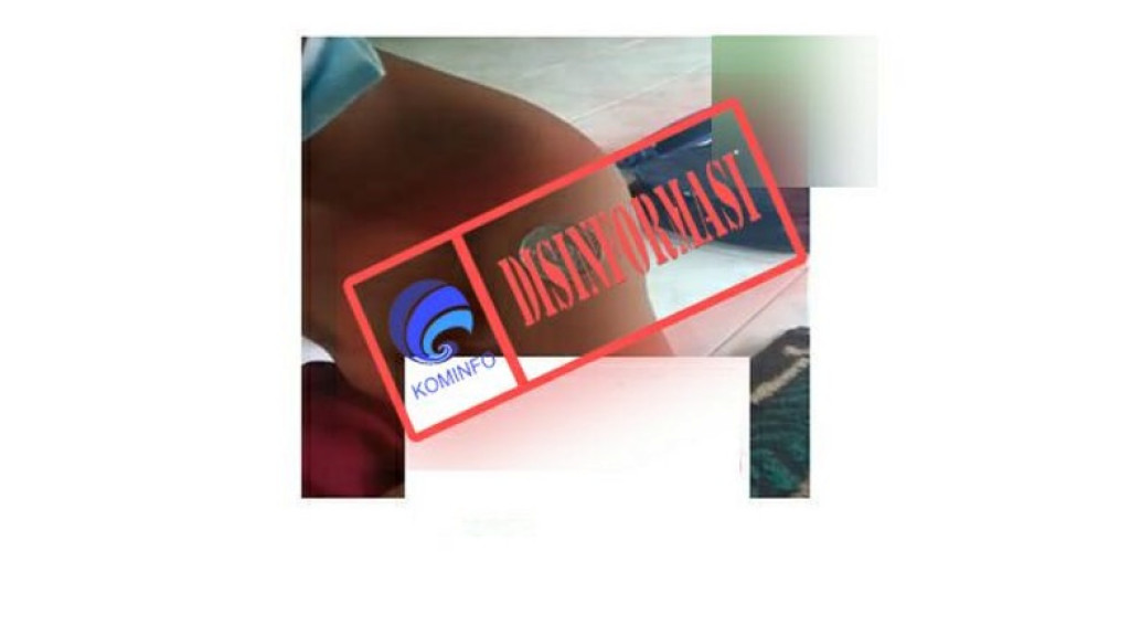 [DISINFORMASI] Uang Koin Bisa Menempel pada Lengan Anak yang Sudah Vaksin