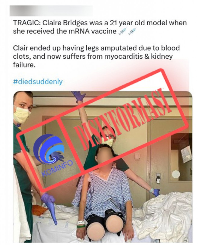 [DISINFORMASI] Seorang Wanita di Florida Diamputasi Kakinya karena Alami Pembekuan Darah akibat Vaksin Covid-19