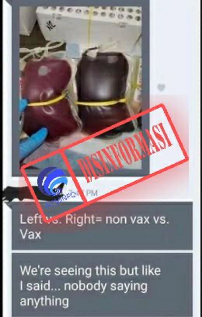 [DISINFORMASI] Warna Darah Pasien yang Sudah Disuntik Vaksin Covid-19 Berubah