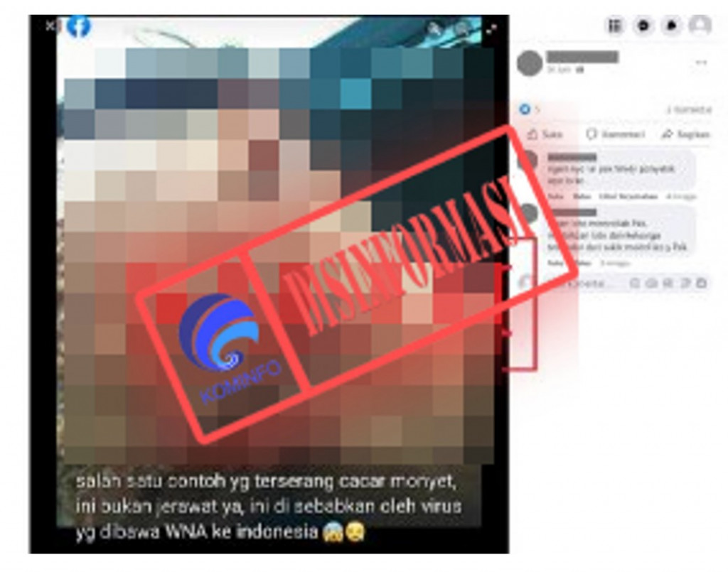 [DISINFORMASI] Foto Cacar Monyet Dibawa oleh WNA ke Indonesia